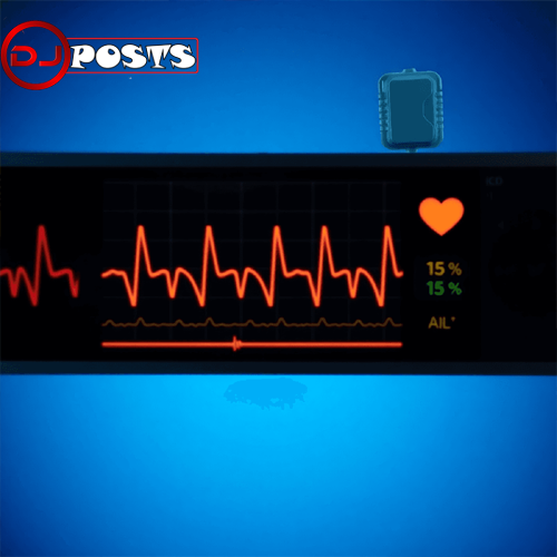 Understanding Atrial Fibrillation ICD: A Comprehensive Guide 2 atrial fibrillation icd